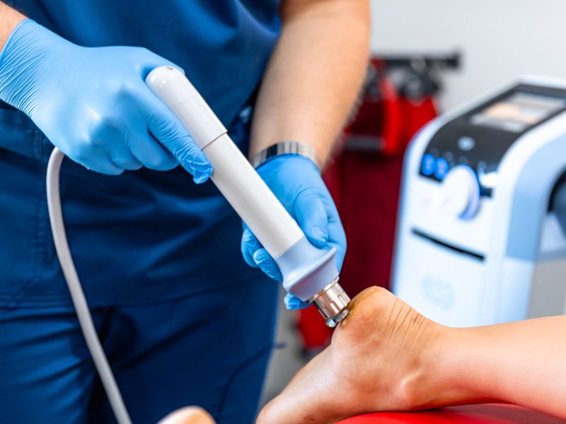 Shock wave therapy, the magnetic field, rehabilitation, physiotherapist doctor performs surgery on a patient's heel.